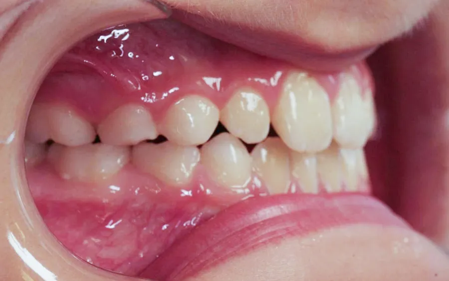 After treatment