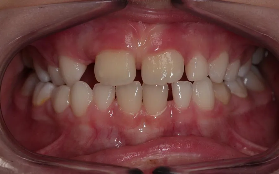 Before treatment