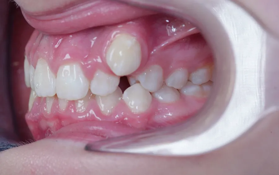 Before treatment