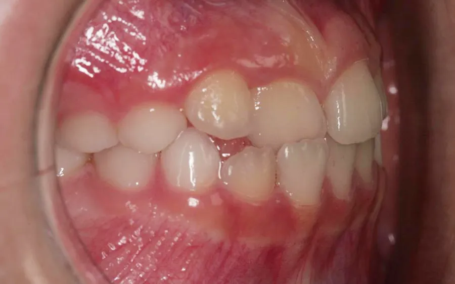 Before treatment