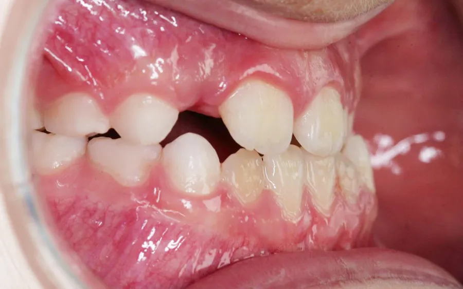 Before treatment