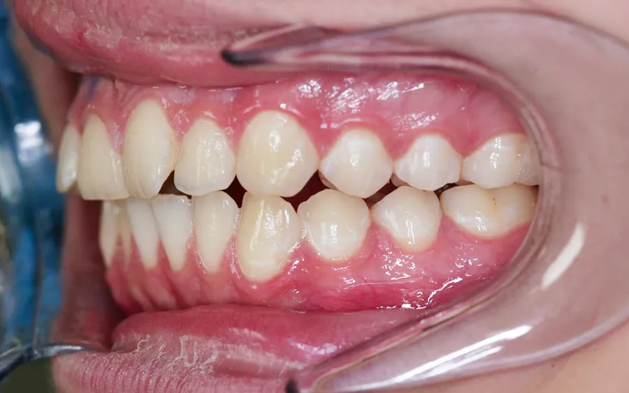 Before treatment