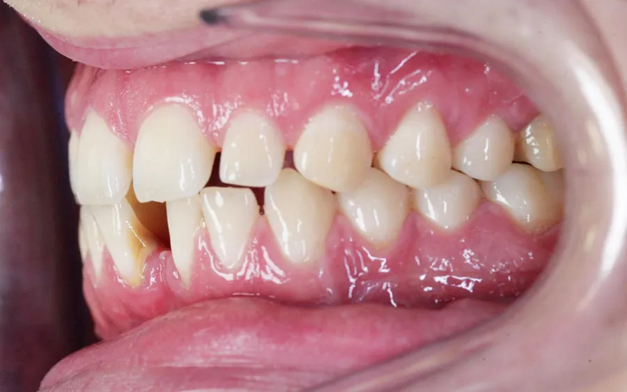 Before treatment