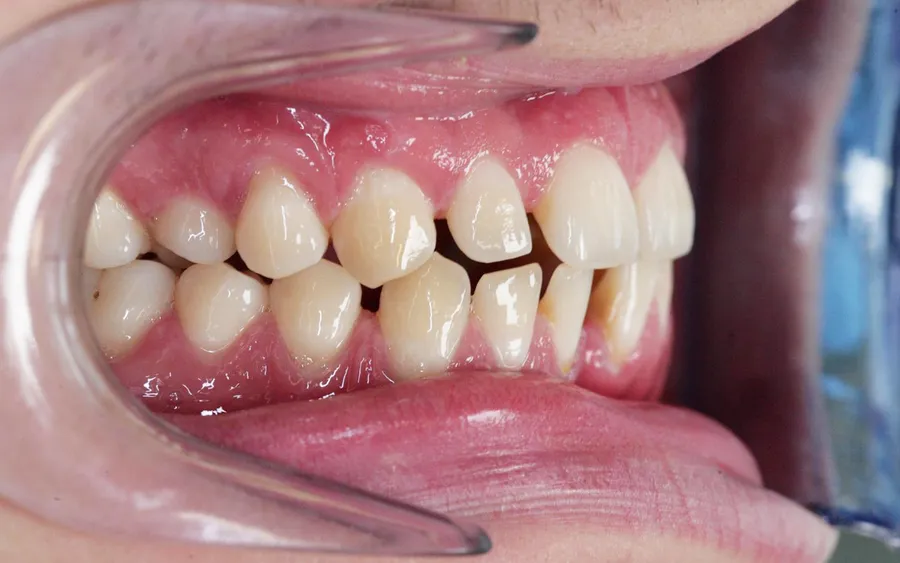 Before treatment