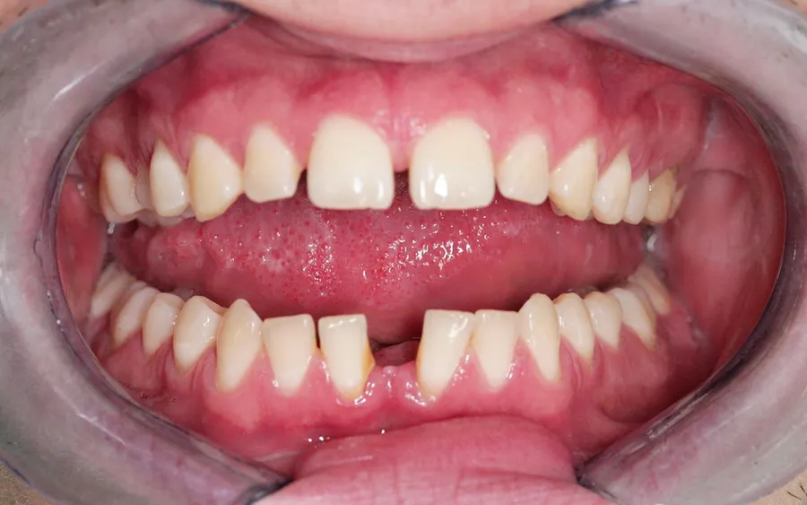 Before treatment